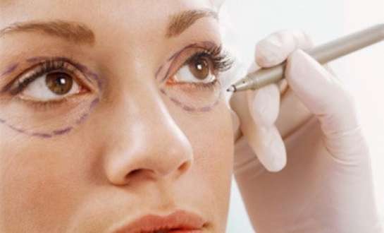 Các loại phẫu thuật thẩm mỹ mắt phổ biến tại Viện thẩm mỹ Icon