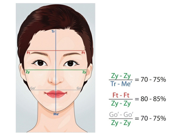 Những điều cần biết về phẫu thuật thẩm mỹ xương mặt