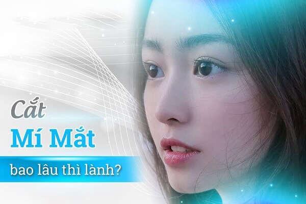 Cắt mí mắt bao lâu thì lành? Lưu ý cần biết để cắt mí đẹp không sẹo