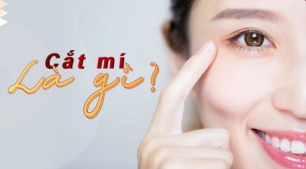 Cắt mí mắt bao lâu thì lành? Lưu ý cần biết để cắt mí đẹp không sẹo