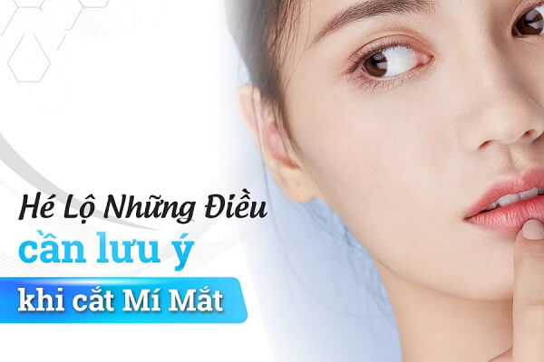 Cắt mí mắt bao lâu thì lành? Lưu ý cần biết để cắt mí đẹp không sẹo