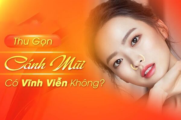 Thu gọn cánh mũi có vĩnh viễn không? Những điều cần lưu ý