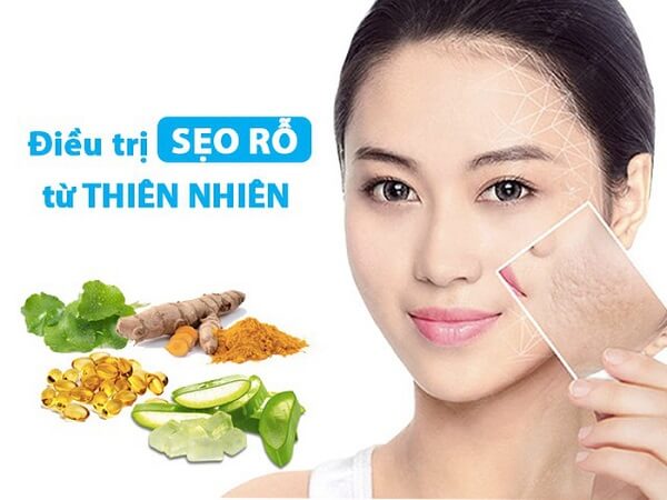 Nguyên nhân và Phương pháp điều trị sẹo rỗ hiệu quả nhanh