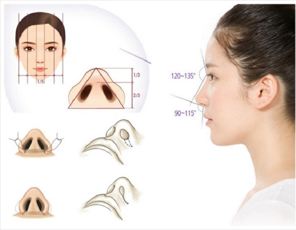 Mũi diều hâu là gì? Tốt hay xấu? Có nên sửa mũi diều hâu không?