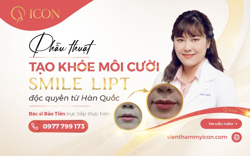 Phẫu thuật tạo khóe môi cười Smile Lipt độc quyền từ Hàn Quốc