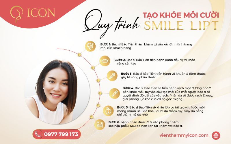 Phẫu thuật tạo khóe môi cười Smile Lipt độc quyền từ Hàn Quốc