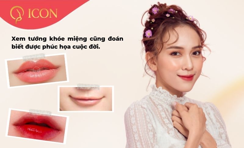 Khóe miệng hướng lên hoặc trễ xuống đẹp hay xấu? Cải thiện như thế nào