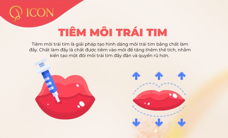 Tiêm môi trái tim: xu hướng làm đẹp mới nhất năm 2023