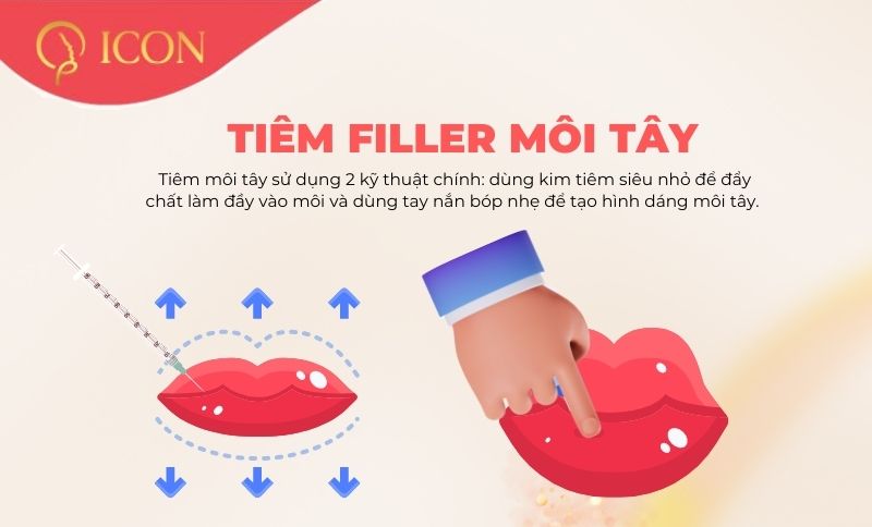 Môi tây là gì? Làm gì để có kiểu môi tây thời thượng nhất 2022?